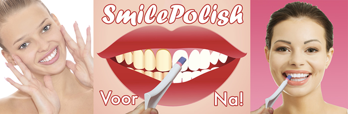 SmilePolish®, persoonlijke verzorging, gezicht en gebit, Met spectaculair schone tanden is uw lach zoveel aantrekkelijker