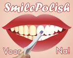 HollywoodSmiles®, De gemakkelijkste manier ooit om weer schitterende witte tanden te krijgen
