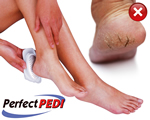 Original PerfectPedi®, comfortsenior, gezond & fit, Doeltreffende, veilige, pijnloze en uiterst scherp geprijsde voetverzorging
