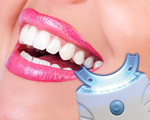 HollywoodSmiles®, similar on TV, De gemakkelijkste manier ooit om weer schitterende witte tanden te krijgen