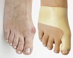 FootPad®, Deze FootPads® verlichten uw voetpijn en corrigeert de uitlijning van uw voet